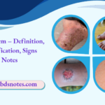 Gangrenem – Definition, Classification, Signs Notes