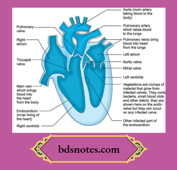 Indication for cardiac surgery