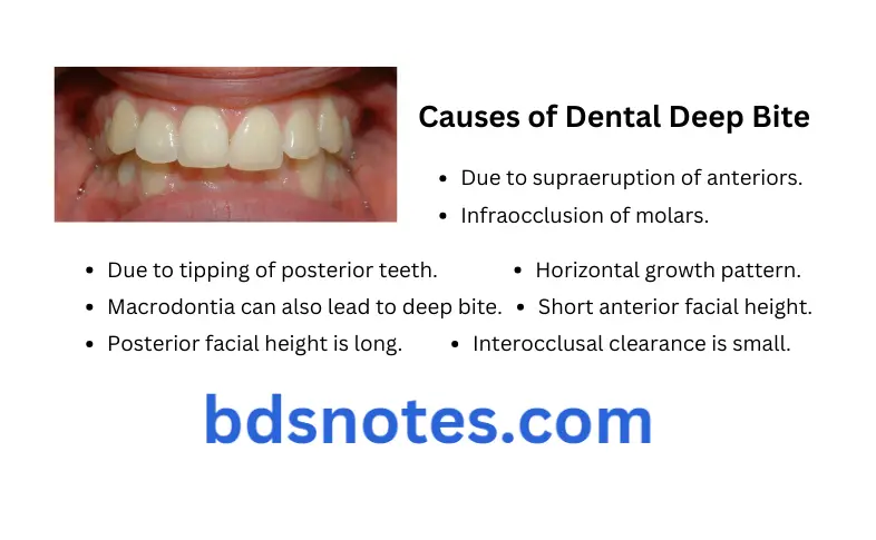 Management Of Open Bite And Deep Bite Question And Answers Causes of Dental deep bite