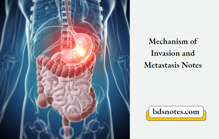 Mechanism of Invasion and Metastasis Notes