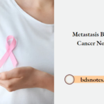 Metastasis Breast Cancer Notes
