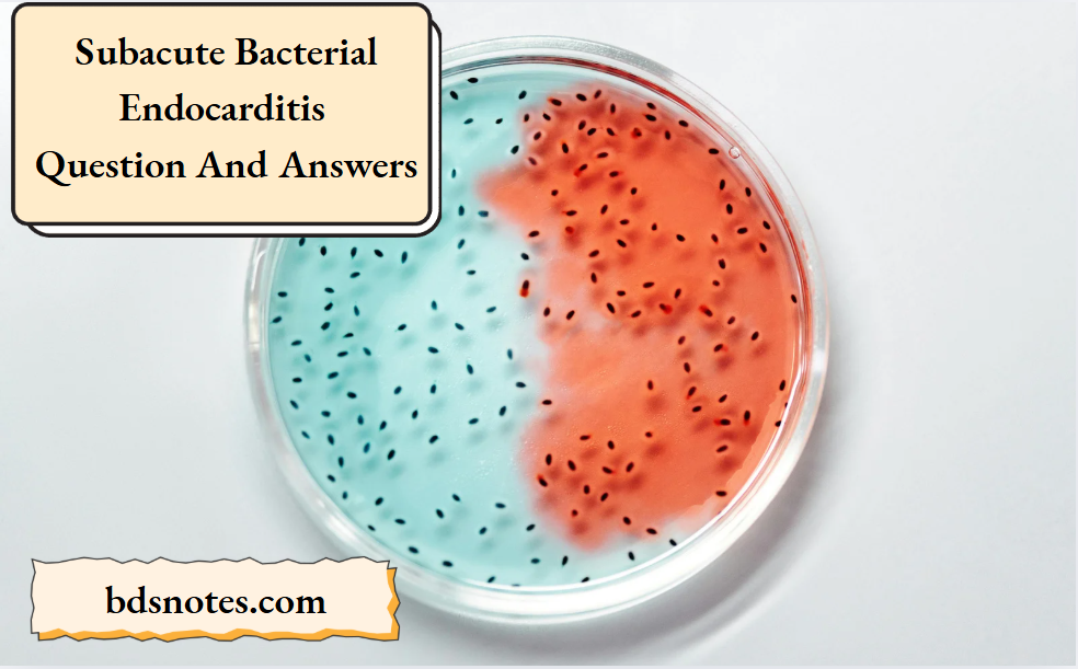 Subacute Bacterial Endocarditis Question And Answers