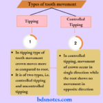 Types of tooth movement