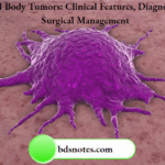 Carotid Body Tumors Clinical Features, Diagnosis, And Surgical Management