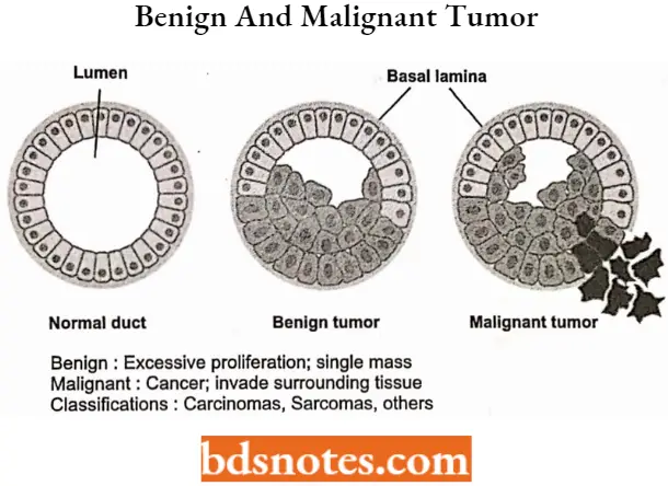 Antineoplastic Drugs Benign And Malignant Tumor