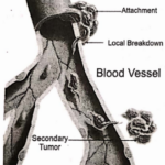 Antineoplastic Drugs Travel Of Cancer Cells