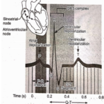 Anti-Arrhythmic Agents Normal Electrocardiogram