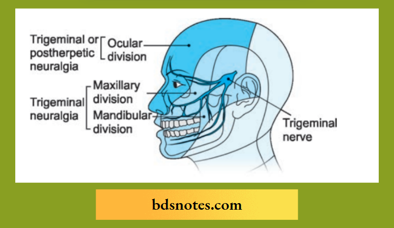 Trigeminal neuralgia