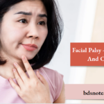 Facial Palsy - Symptoms And Causes