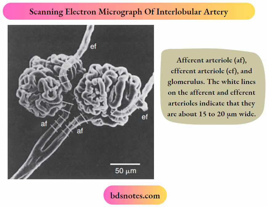 Structure And Function Of The Kidneys Scanning Electron Micrograph Of Interlobulary Artery, Afferent Arteriole, Effect Arteriole, And Hlomerulus