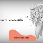 Aggressive Periodontitis