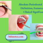 Absolute Periodontal Pocket