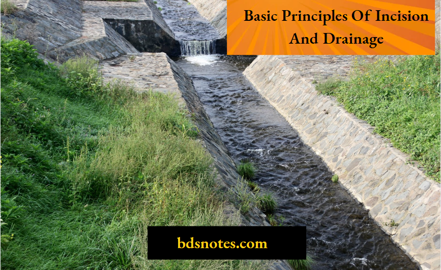 Basic Principles Of Incision And Drainage