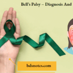 Bells Palsy – Diagnosis And Treatment