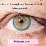 Capillary Hemangioma Treatment And Management