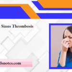 Cavernous Sinus Thrombosis