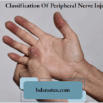 Classification Of Peripheral Nerve Injury