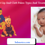 Cleft Lip And Cleft Palate Types And Treatment