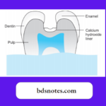 Composition of Cavity Liners