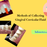 Gingival Crevicular Fluid Collection