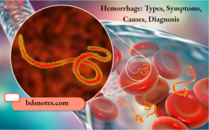 HEMORRHAGE SIGNS CAUSES AND MORE visual data 8