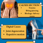 Mucous Cyst Types Causes Retro