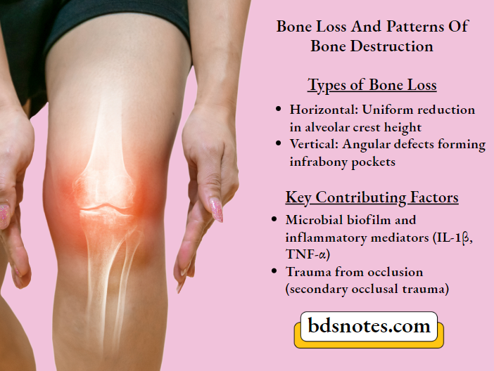 Periodontal Bone Loss Patterns Management