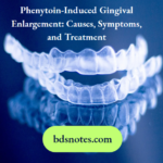 Phenytoin-Induced Gingival Enlargement- Causes, Symptoms, and Treatment