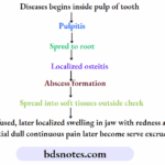 Tooth infection progression