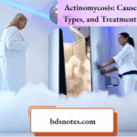 Actinomycosis Causes, Clinical Types, and Treatment Strategies