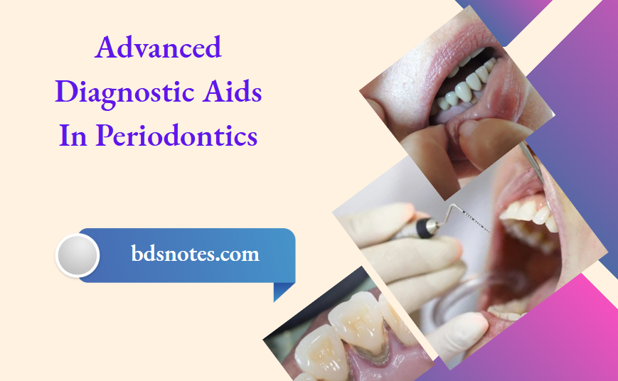 Advanced Diagnostic Aids In Periodontics