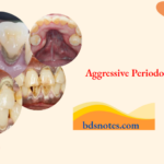 Aggressive Periodontitis