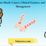 Anaphylactic Shock Causes, Clinical Features, and Emergency Management