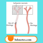 Anatomical end artery