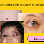 Capillary Hemangioma Treatment & Management