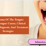 Carcinoma Of The Tongue CausesTongue Causes Clinical Features Diagnosis And Treatment Strategies
