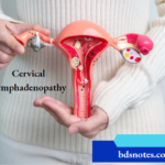 Cervical Lymphadenopathy