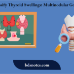 Classify Thyroid Swellings Multinodular Goiter