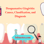 Desquamative Gingivitis Causes Classification