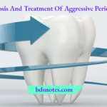 Diagnosis And Treatment Of Aggressive Periodontitis