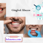 Gingival Abscess