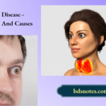 Graves Disease - Symptoms And Causes