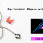 Hyperthyroidism - Diagnosis And Treatment