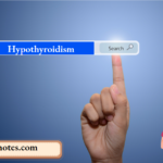 Hypothyroidism