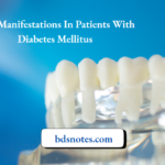 Oral Manifestations In Patients With Diabetes Mellitus