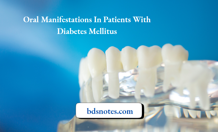 Oral Manifestations In Patients With Diabetes Mellitus