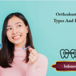 Orthodontic Wires Types And Properties