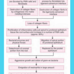 Periodontal Pocket Formation