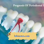 Prognosis Of Periodontal Disease