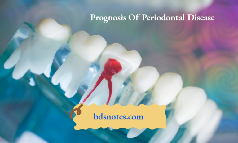 Prognosis Note Prognosis Of Periodontal Disease - BDS Notes